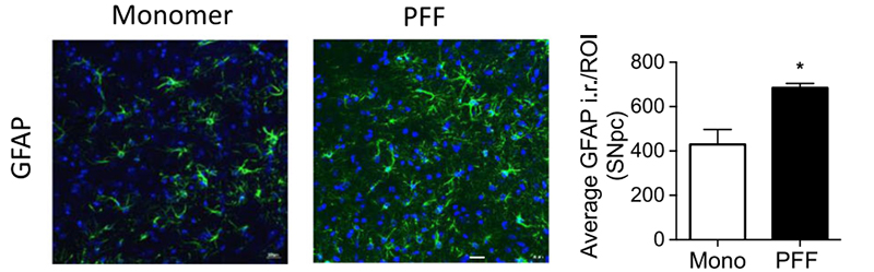 Immunohistochemical GFAP staining of the substantia nigra pars compacta region in a mouse brain.