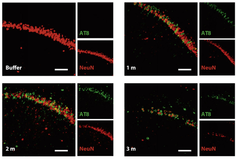 Nissl staining of the hippocampus of P301L mice injected with buffer or truncated tau PFFs.