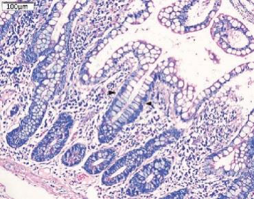 Inspiring Target: Integrin α4/β7 (LPAM-1)