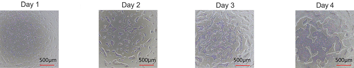 Utilizing GMP-Grade Laminin for Scalable Manufacturing of iPSC-Derived Cell Therapies