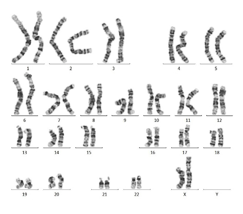 Utilizing GMP-Grade Laminin for Scalable Manufacturing of iPSC-Derived Cell Therapies