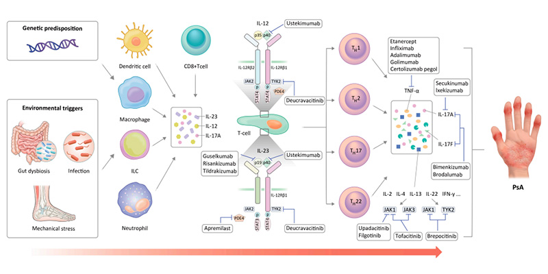 Interpreting the Association Between Cytokines and Autoimmune Diseases