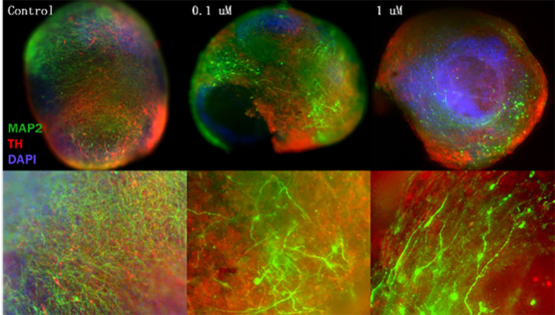 Parkinson’s Disease Modeling