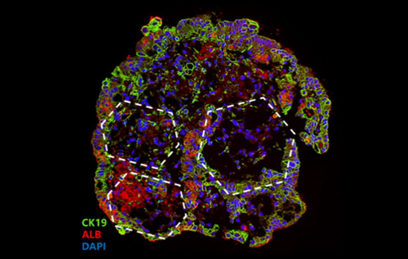 Immunostaining of Liver organoid