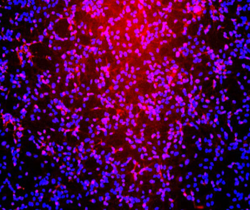 The specificity of NG2 antibody was verified by immunofluorescence