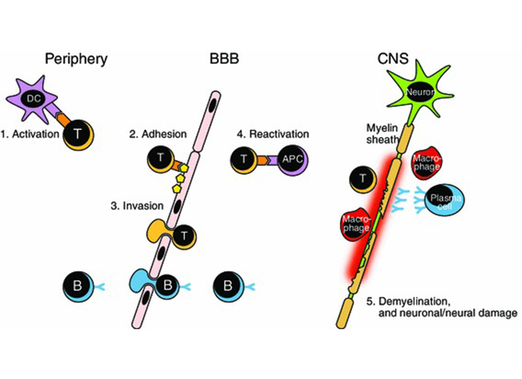 The roles of immune cells in multiple sclerosis pathogenesis