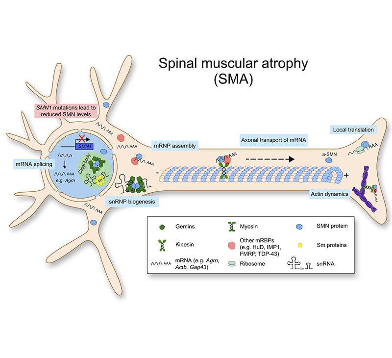 Pathogenesis of SMA