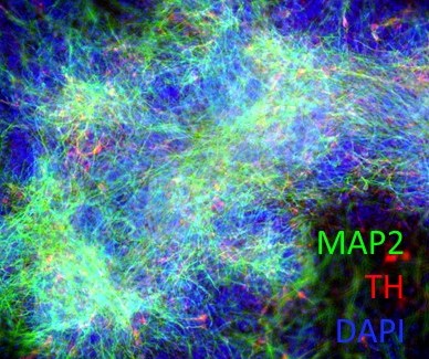 Neural Progenitor Cells Differentiate Into Dopamine Neurons