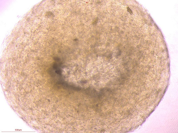 Blood vessel organoids