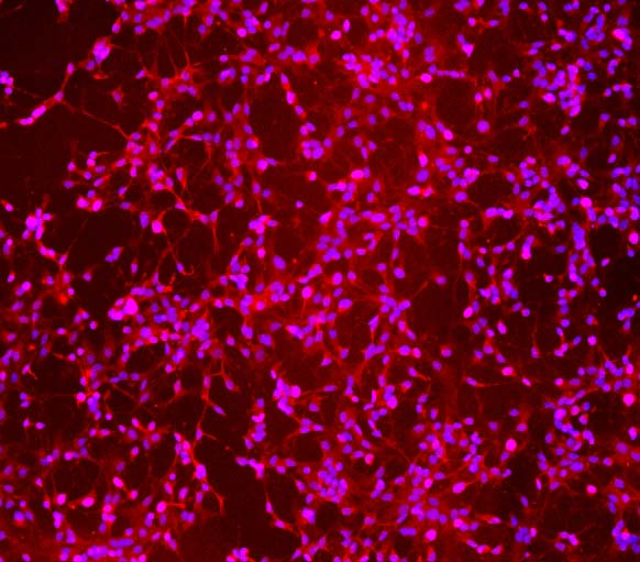  Olig2 IMMUNOSTAINING