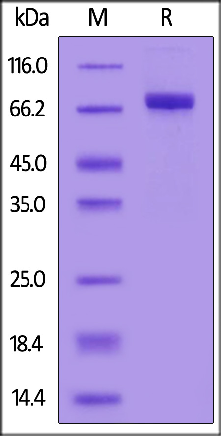 Human ACHE, His Tag (Cat. No. AHE-H52H3) SDS-PAGE gel