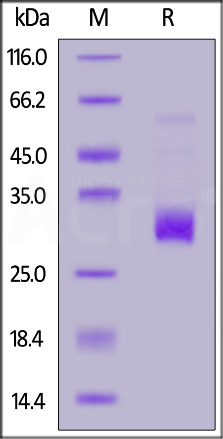 Angiopoietin-2 SDS-PAGE