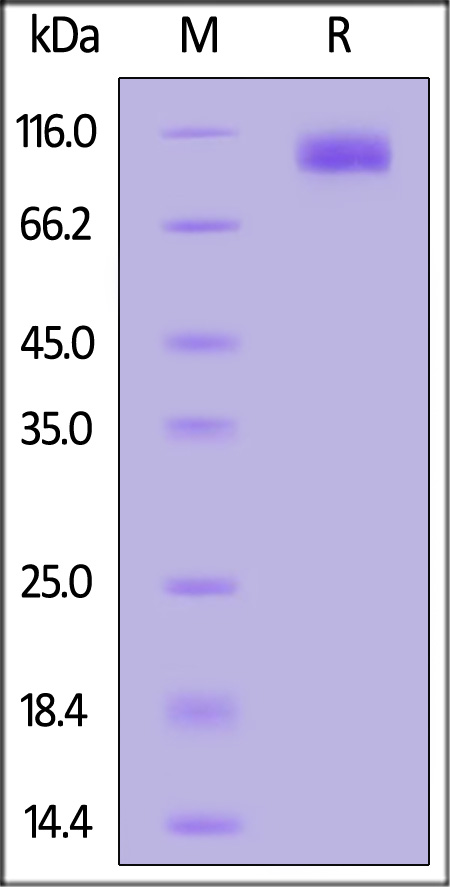 Human SAPPbeta, His Tag (Cat. No. APP-H52H5) SDS-PAGE gel