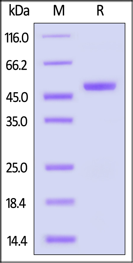 Carbonic Anhydrase IX SDS-PAGE