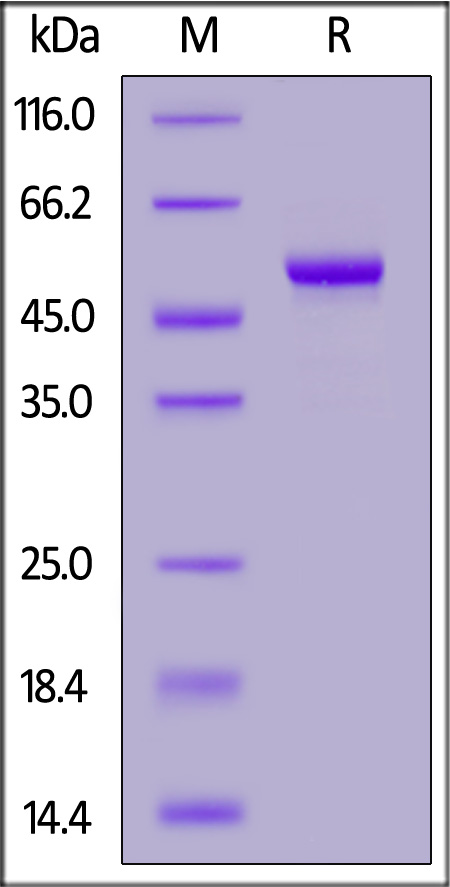 Carbonic Anhydrase IX SDS-PAGE