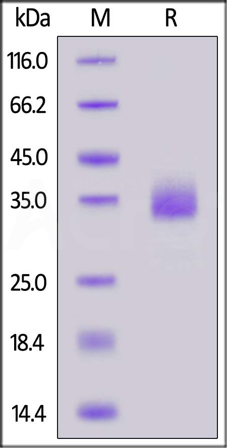 Human CD72, His Tag (Cat. No. CD2-H52H3) SDS-PAGE gel