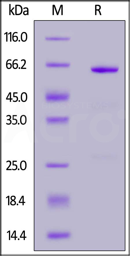 Rabbit CD73, His Tag (Cat. No. CD3-R52H3) SDS-PAGE gel