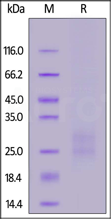 Mouse CD7, His Tag (Cat. No. CD7-M52H3) SDS-PAGE gel