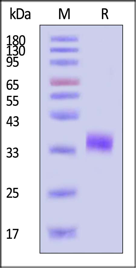 Fc gamma RIIB/C / CD32b/c SDS-PAGE