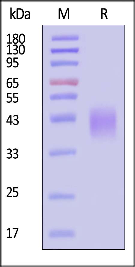 Fc gamma RIIIB / CD16b (NA2) SDS-PAGE