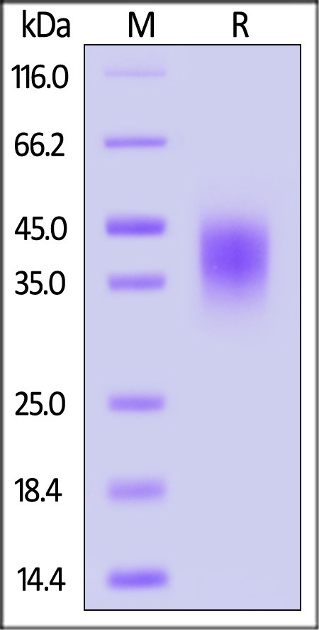 Fc gamma RIIB / CD32b SDS-PAGE