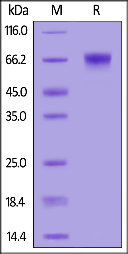 Cynomolgus LILRB1, His Tag (Cat. No. CDJ-C52H3) SDS-PAGE gel