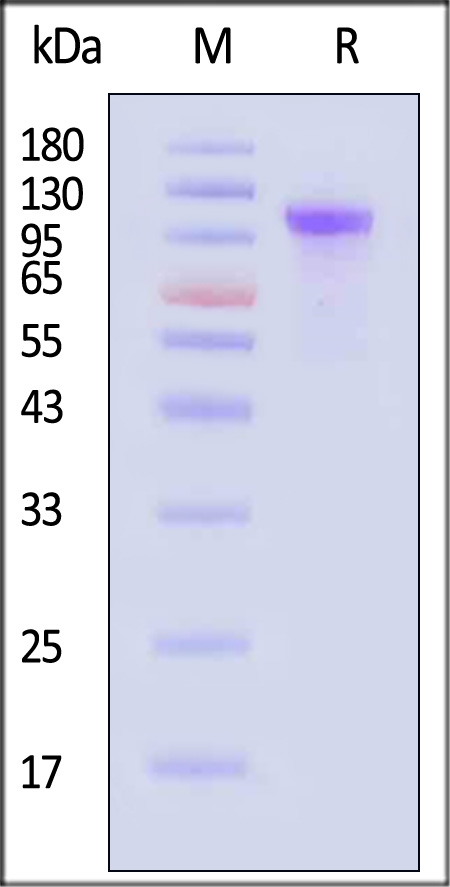 Complement C2 SDS-PAGE