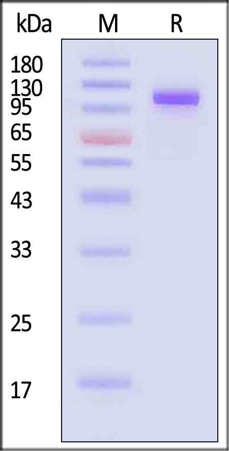 Complement C2 SDS-PAGE