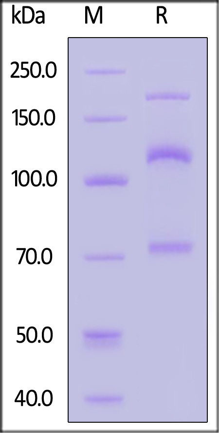 Complement C3 SDS-PAGE