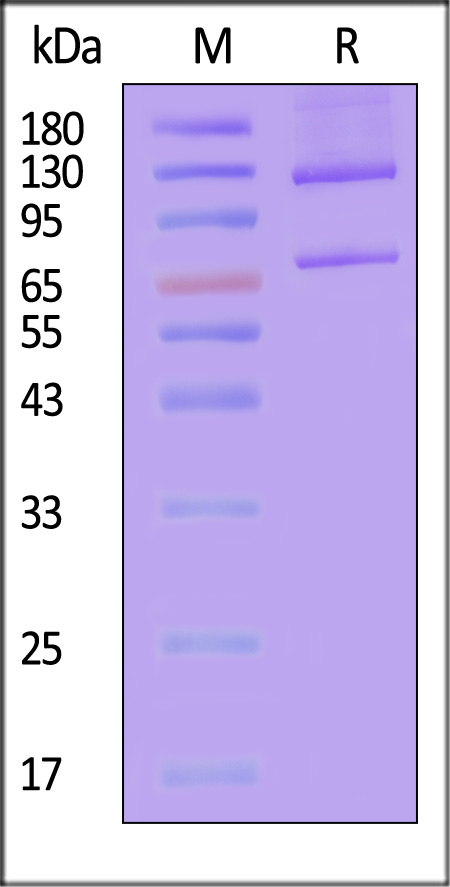 Complement C5 SDS-PAGE