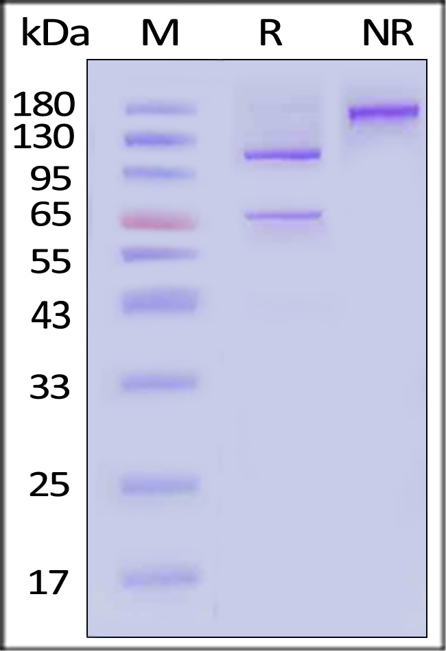 Complement C5 SDS-PAGE