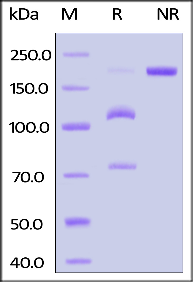 Complement C5 SDS-PAGE