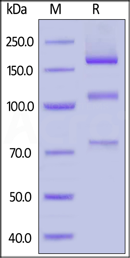 Rabbit Complement C5, His Tag (Cat. No. CO5-R52H4) SDS-PAGE gel