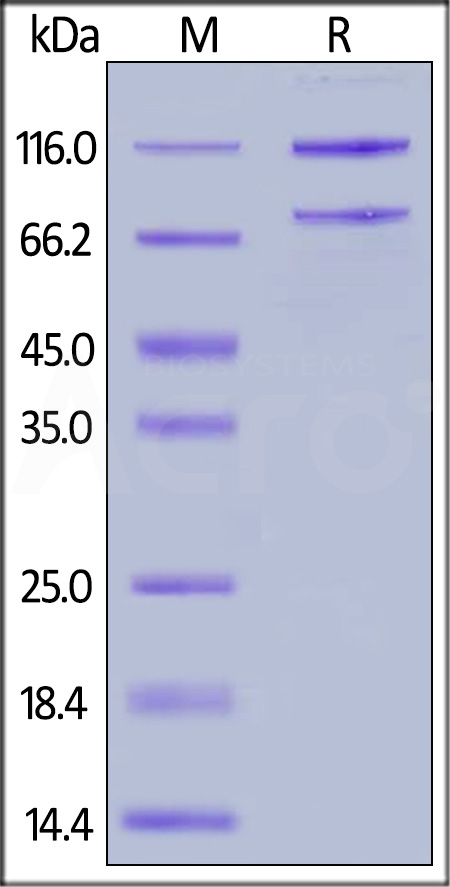 Complement C5 SDS-PAGE