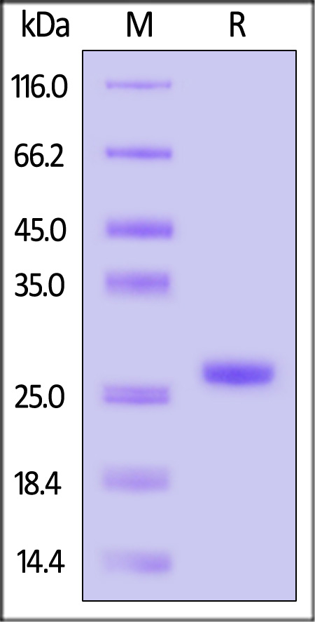 Capsid protein p24 SDS-PAGE