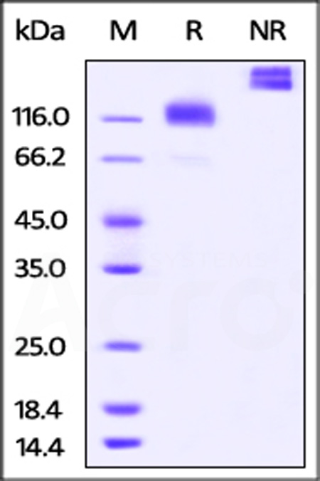 M-CSF R SDS-PAGE