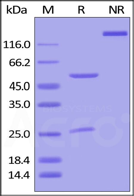 IgG control SDS-PAGE