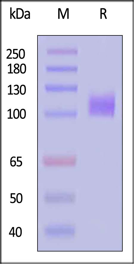 EGF R SDS-PAGE