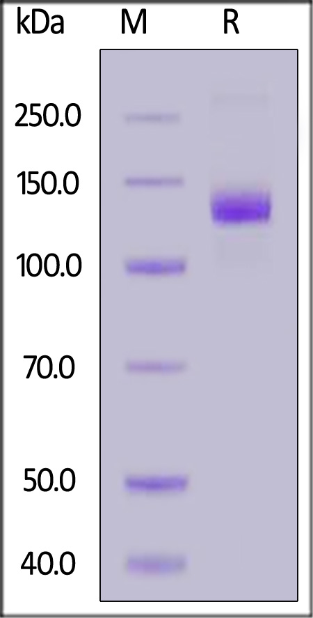 EGF R SDS-PAGE