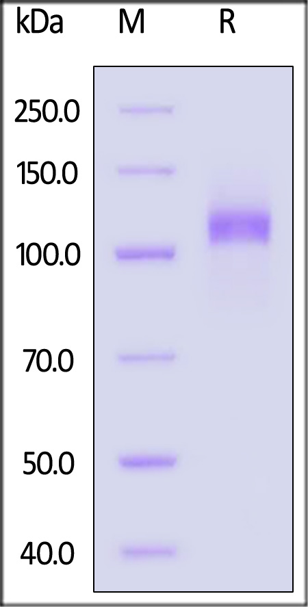 EGF R SDS-PAGE