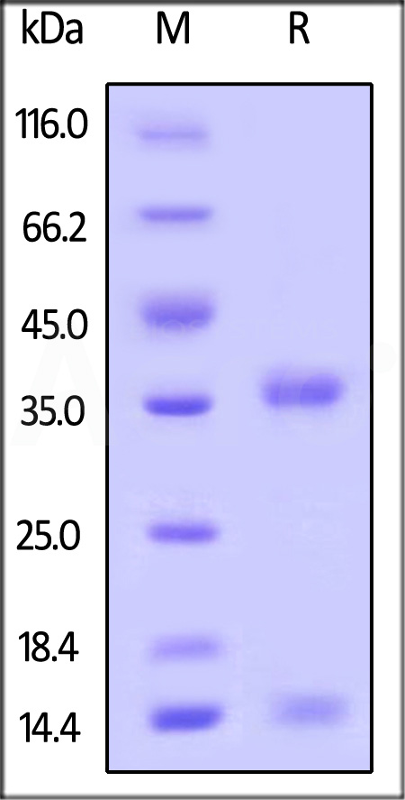 FcRn (FCGRT & B2M) SDS-PAGE