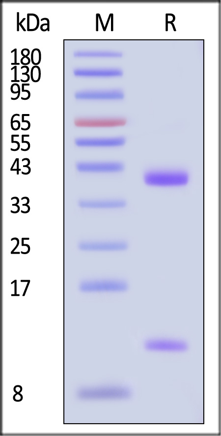 FcRn (FCGRT & B2M) SDS-PAGE