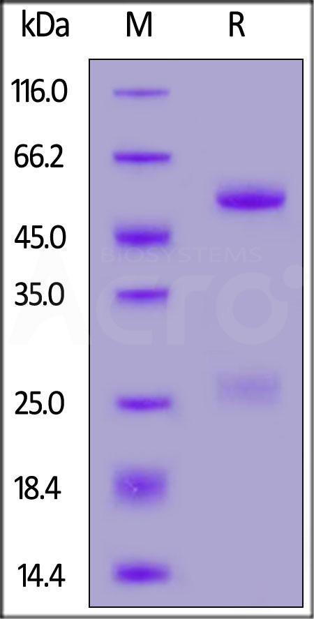 FMC63 SDS-PAGE