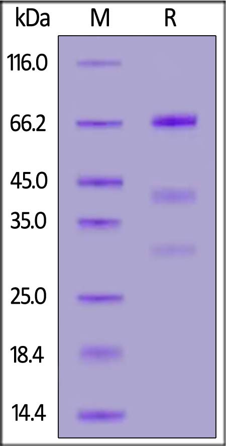 Glypican 3 SDS-PAGE