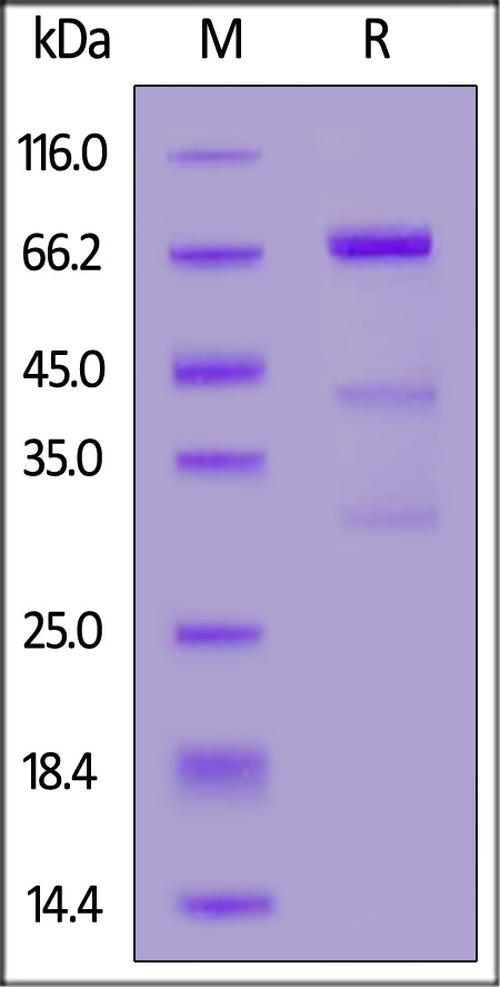 Glypican 3 SDS-PAGE