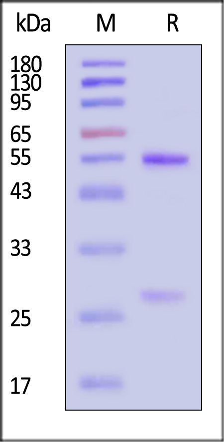 Hemagglutinin (HA) SDS-PAGE