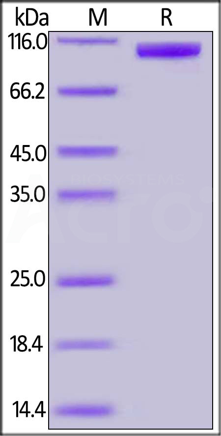 Hemagglutinin (HA) SDS-PAGE