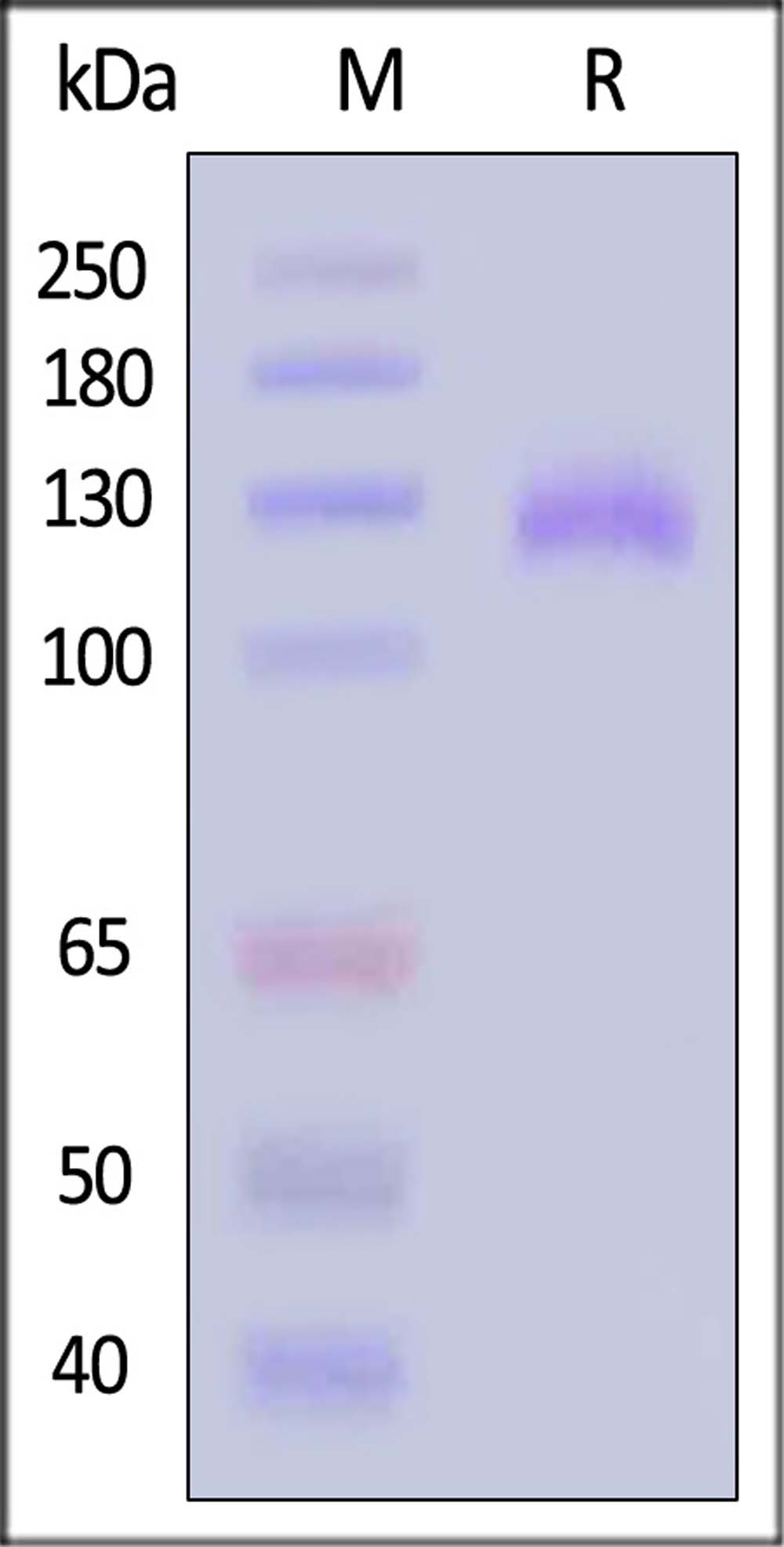 Her2 SDS-PAGE