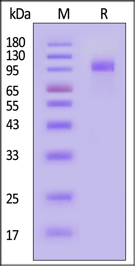 Her2 SDS-PAGE