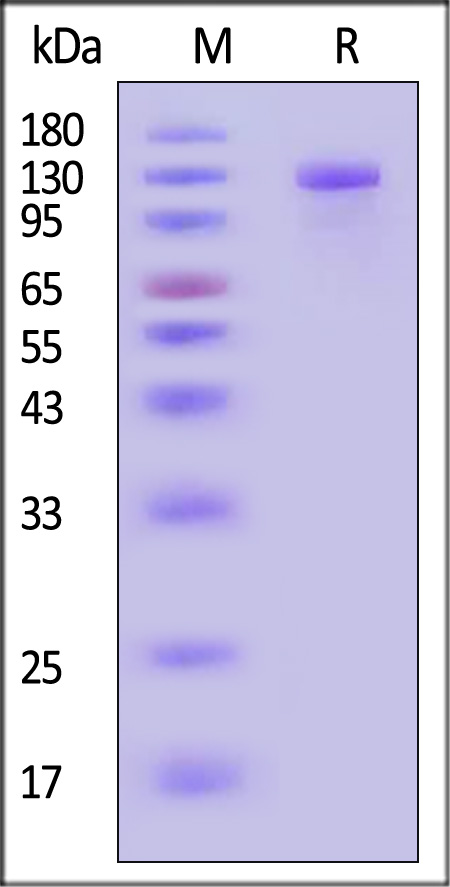 Her2 SDS-PAGE